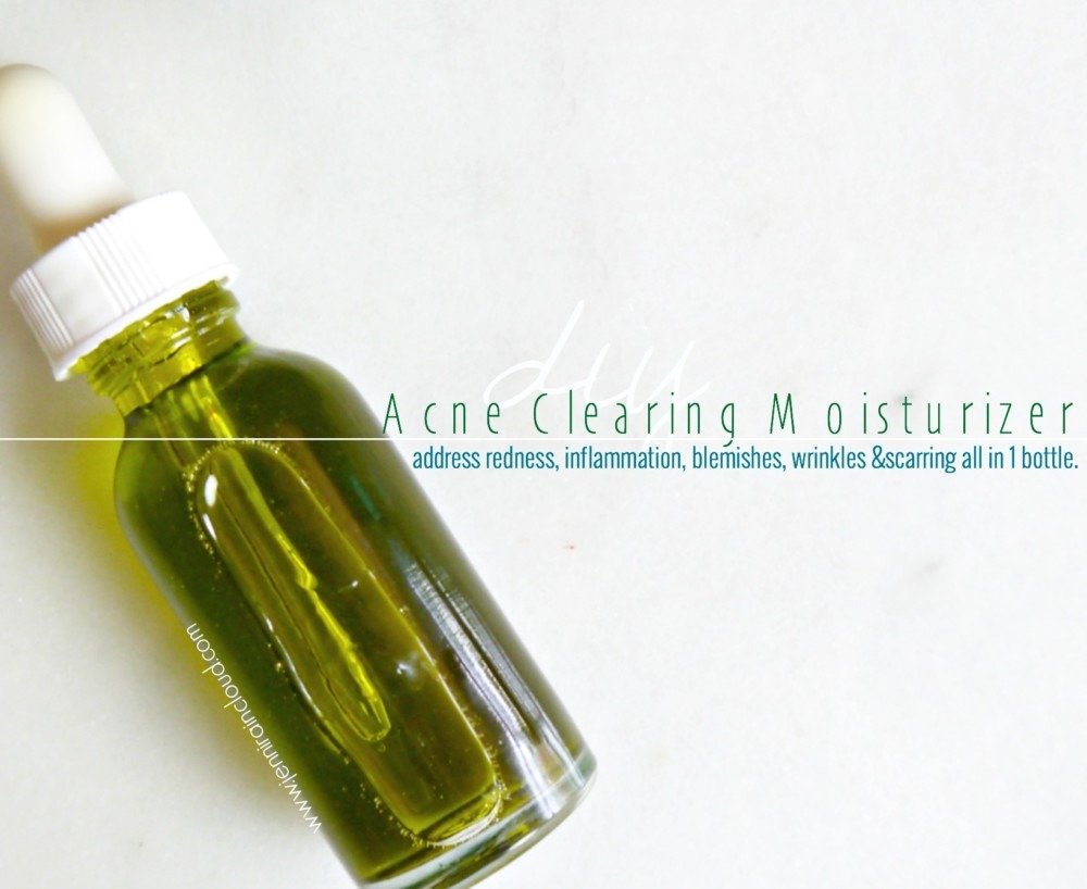 Acne Clearing Moisturizer DIY