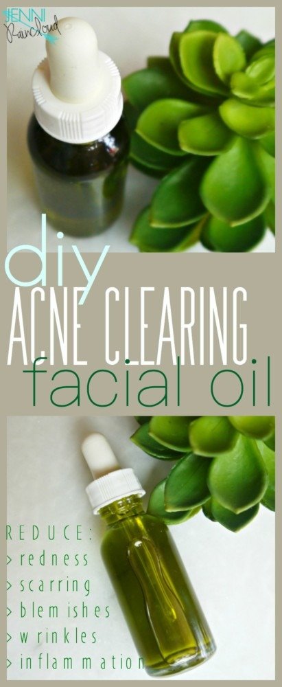 Acne Clearing Facial Oil DIY