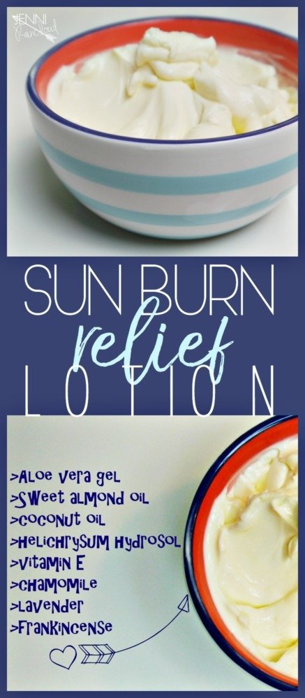 Sun Burn Relief Lotion DIY