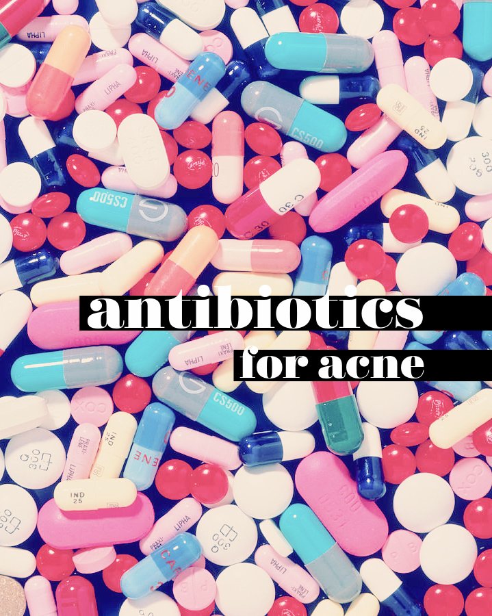Antibiotics for Acne